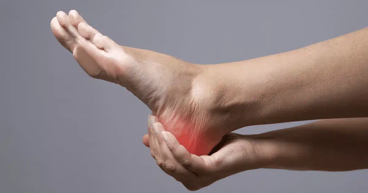 What You Should Know About Plantar Fasciitis