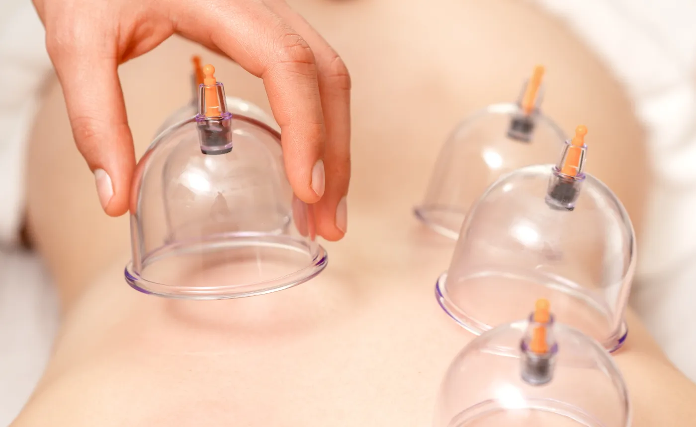 Cupping Chino Hills